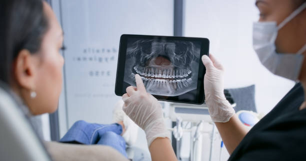 Licensed Tooth Extraction service in Mission Viejo, CA - Smile Center Dentistry
